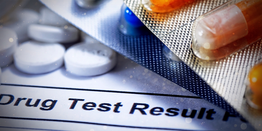 Zijn Paddo's En Truffels Zichtbaar Bij Een Drugstest? 